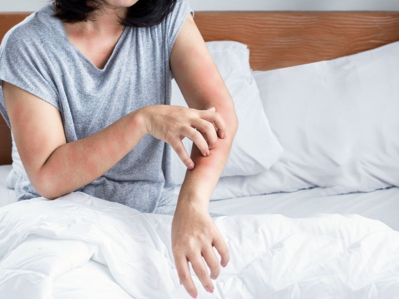 o que é cama box conjugada e alergias